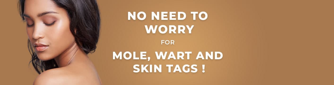 Mole Wart And Skin Tags