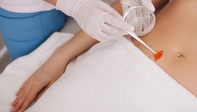 About Body Peels Treatment