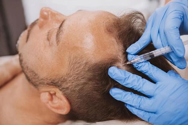 HAIR GROWTH STIMULATION THERAPY PROCEDURES