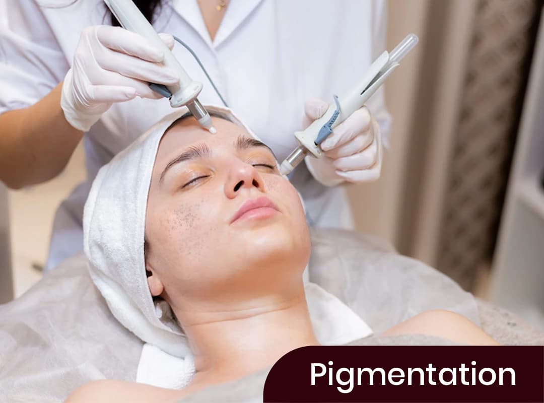 Pigmentation Treatment