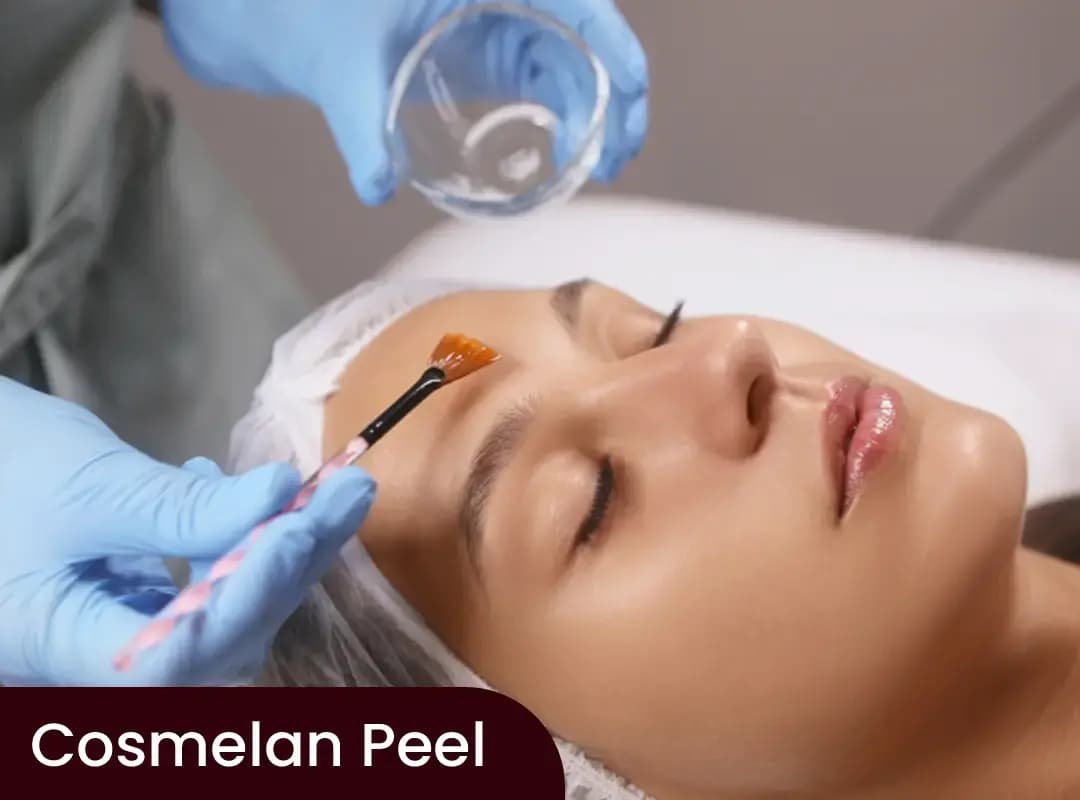 Cosmelan Peel