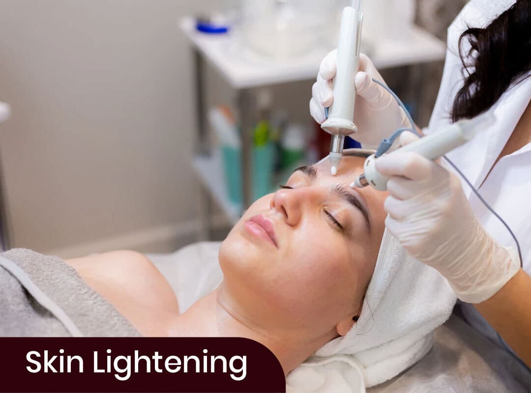 Skin Peel Lightening