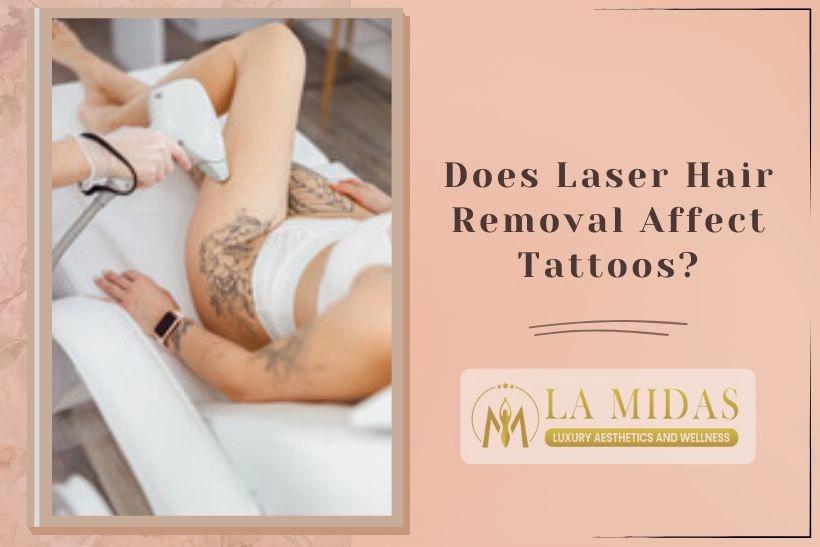 Does Laser Hair Removal Affect Tattoos