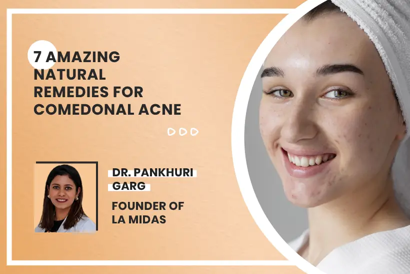 7 Amazing Natural Remedies For Comedonal Acne